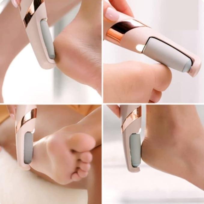 Pedicure Tool - Rechargeable Pedicure Tool File | Callus & Dead Skin Remover